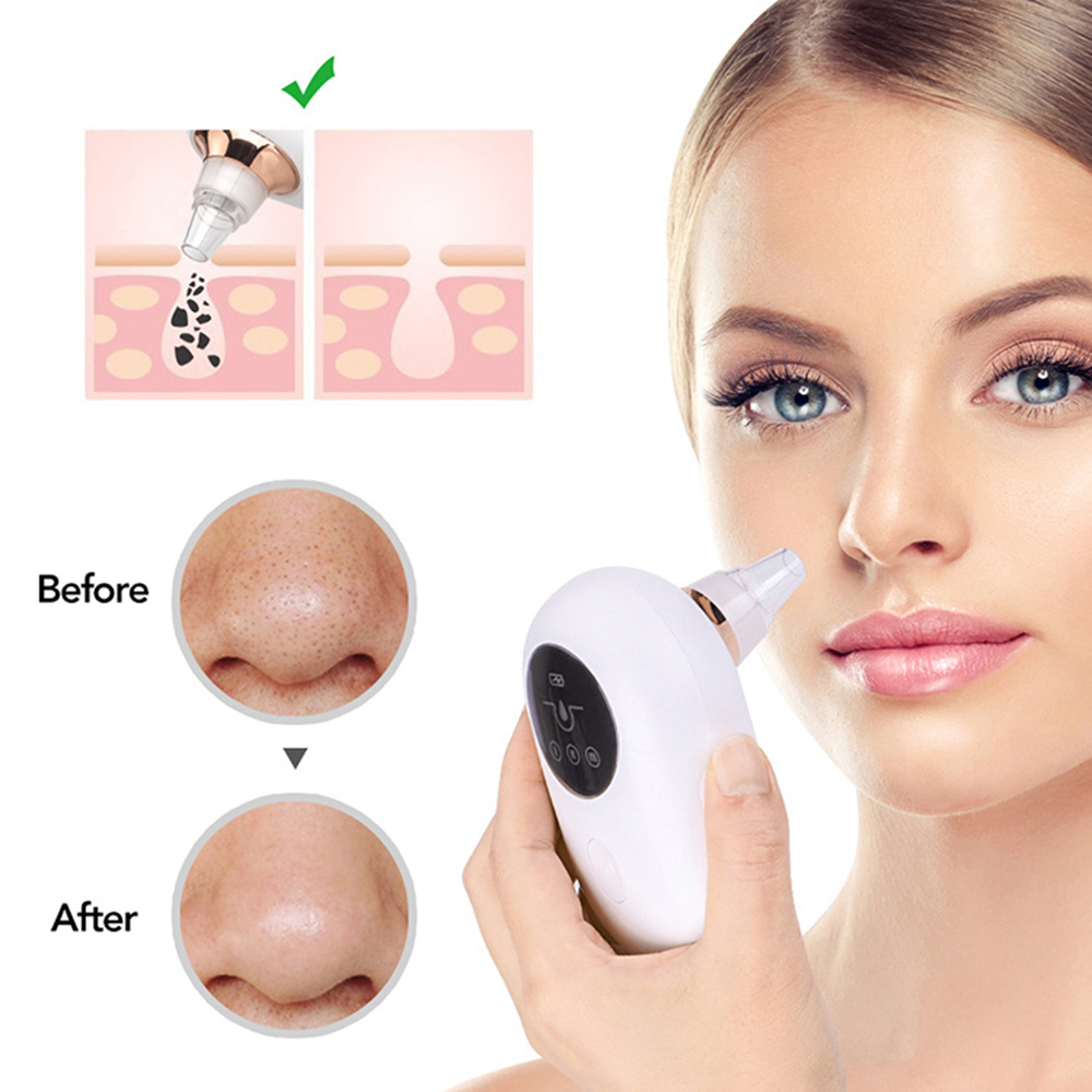 Portable  Face Deep Pore Cleaner Vacuum Blackhead Remover